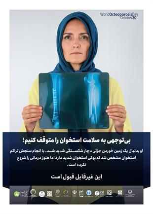 بی توجهی به سلامت استخوان