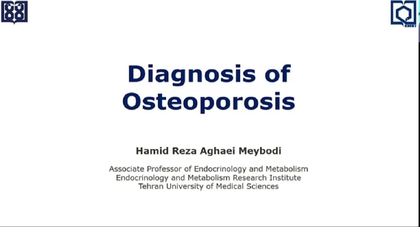 Diagnosis of Osteoporosis