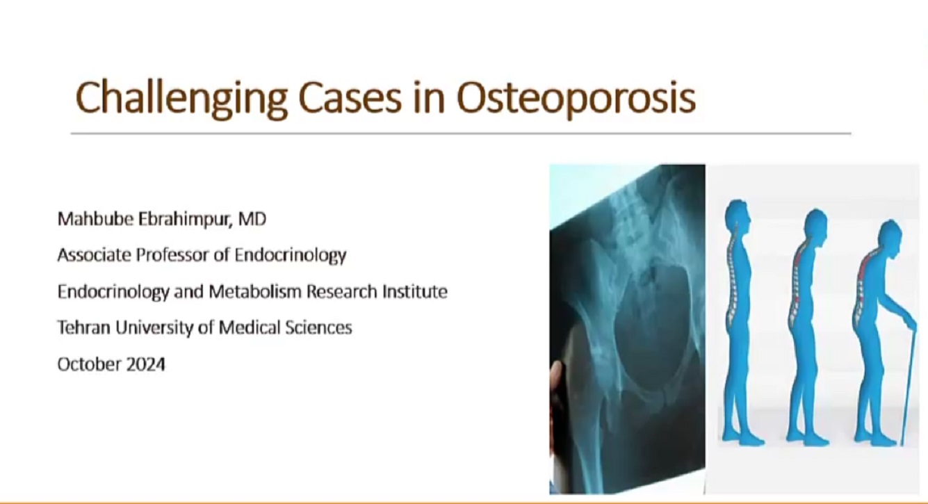 Challenging Cases in Osteoporosis